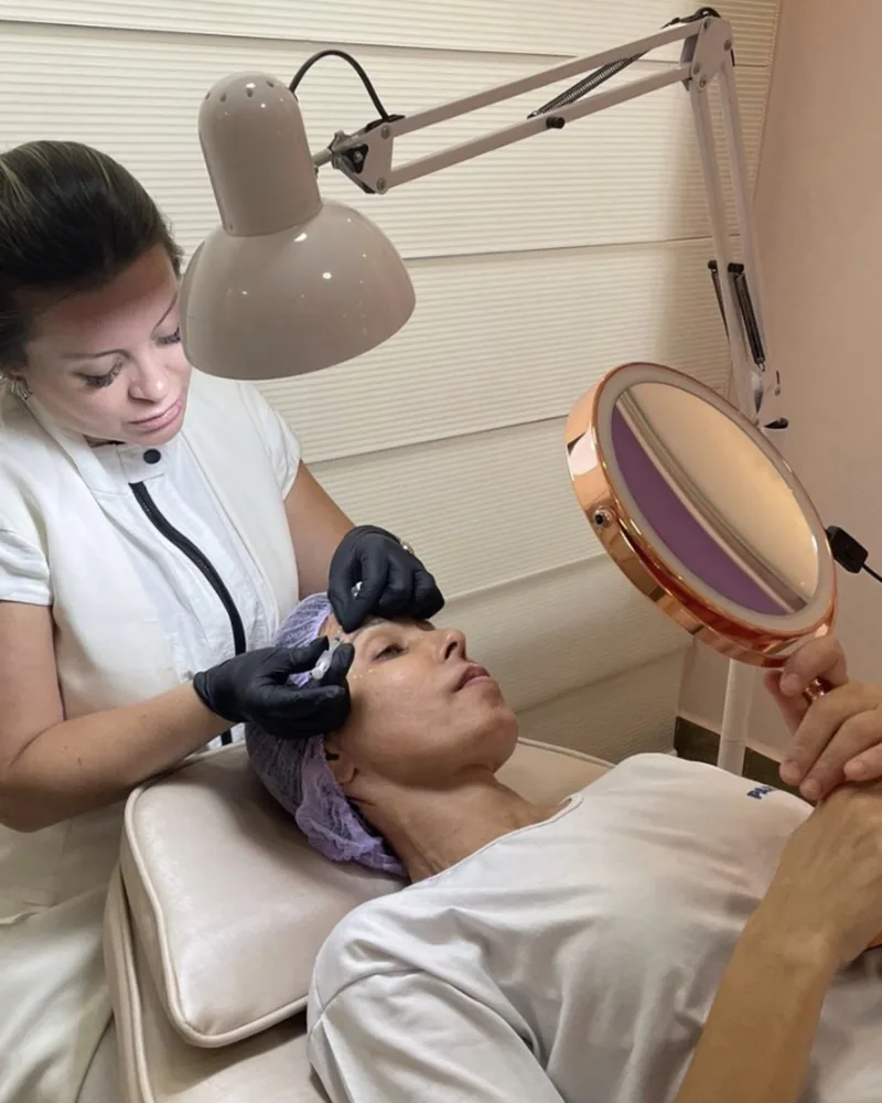 Botox — fotografia fornecida pela clínica