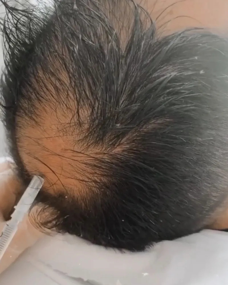 Enzimas capilares — fotografia fornecida pela clínica